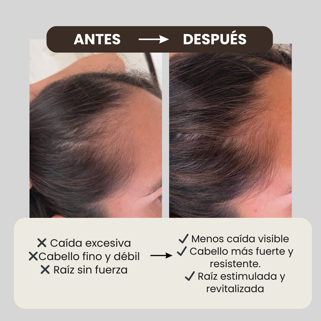 Kit Anticaída 2 Shampoo + 1 Acondicionador