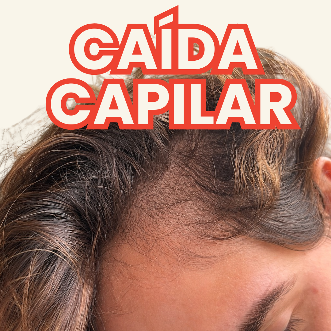 Anticaída