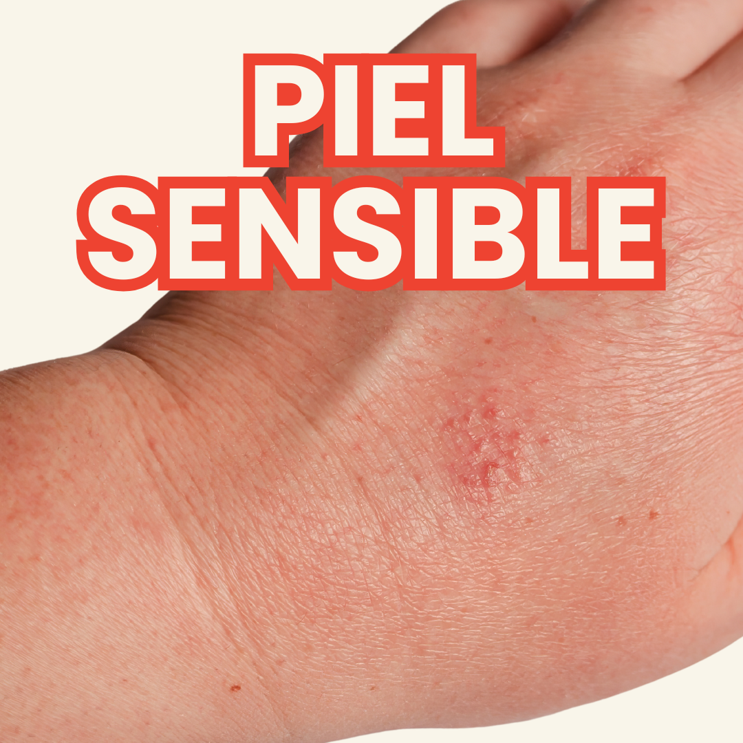 Piel sensible