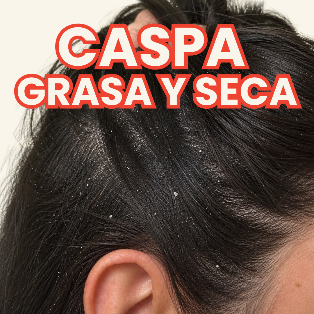 Anticaspa