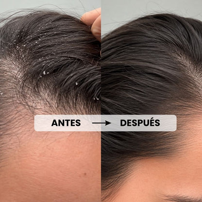 Shampoo Anticaspa / Mr Blue Sky.