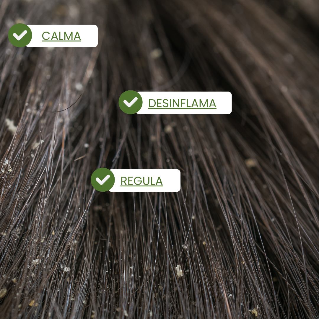 Champú Anticaspa / Mr Blue Sky.