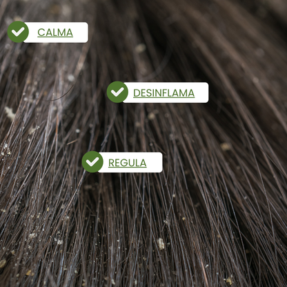 Champú Anticaspa / Mr Blue Sky.