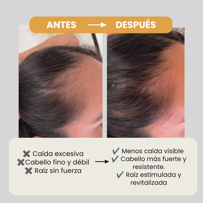 Shampoo anticaída / Bb Please Don't Go.