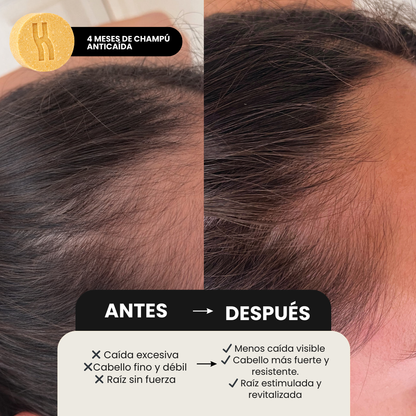 Champú anticaída / Bb Please Don't Go.