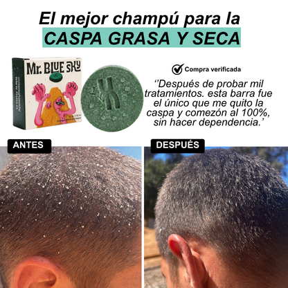 Shampoo Anticaspa / Mr Blue Sky.